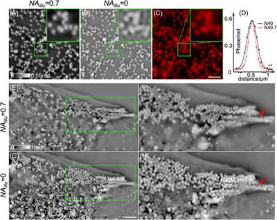 High Spatio-Temporal Resolution Condenser-Free Quantitative Phase Contrast Microscopy